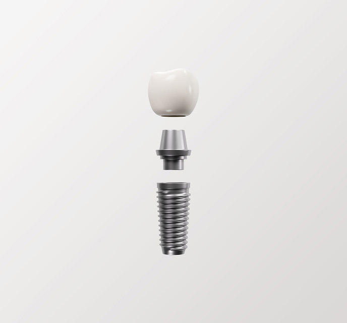 dental implant